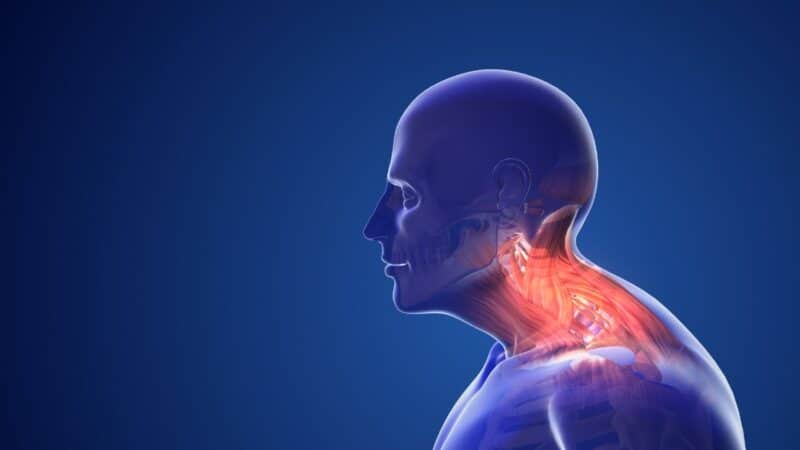 3D Illustration Of Neck Pain