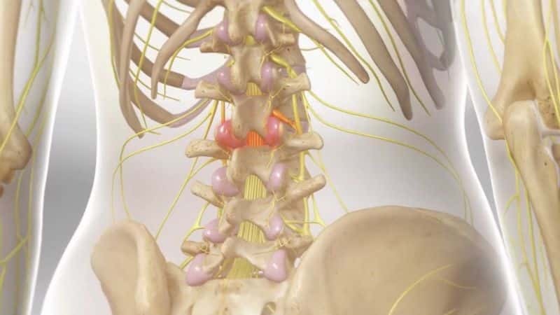 Thoracic Facet Injection in Joliet, IL